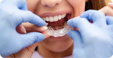 aligneurs invisibles Zenith dental cabinet