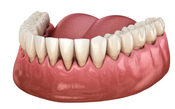 Déchaussement des dents, soins au cabinet dentaire Zenith à Boissy-l’Aillerie à proximité de Cergy-Pontoise et de Paris